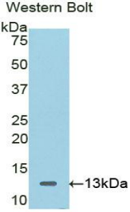 Polyclonal Antibody to Catenin Beta Interacting Protein 1 (CTNNbIP1)