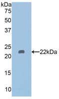 Polyclonal Antibody to Histone Deacetylase 6 (HDAC6)