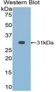 Polyclonal Antibody to Histone Deacetylase 6 (HDAC6)