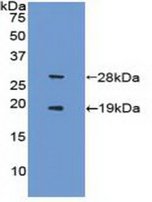 Polyclonal Antibody to Sirtuin 1 (SIRT1)