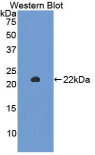 Polyclonal Antibody to Sirtuin 3 (SIRT3)