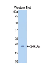 Polyclonal Antibody to Sirtuin 5 (SIRT5)