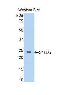 Polyclonal Antibody to Sirtuin 6 (SIRT6)