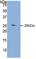 Polyclonal Antibody to Filamin C Gamma (FLNC)