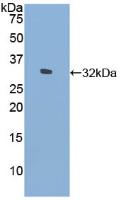 Polyclonal Antibody to Filamin C Gamma (FLNC)