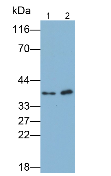 Polyclonal Antibody to Wilms Tumor Protein (WT1)