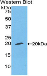 Polyclonal Antibody to Ectonucleotide Pyrophosphatase/Phosphodiesterase 1 (ENPP1)