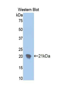 Polyclonal Antibody to Ectonucleotide Pyrophosphatase/Phosphodiesterase 1 (ENPP1)