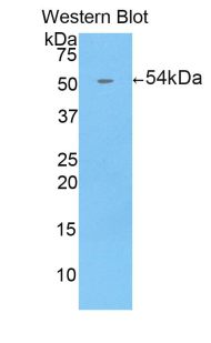 Polyclonal Antibody to Ectonucleotide Pyrophosphatase/Phosphodiesterase 1 (ENPP1)