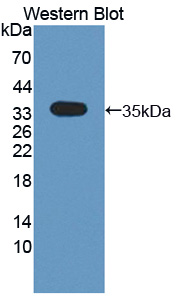 Polyclonal Antibody to Cytokine Receptor Like Factor 1 (CRLF1)