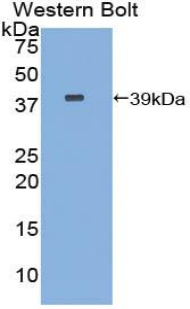 Polyclonal Antibody to Carboxypeptidase B1, Tissue (CPB1)