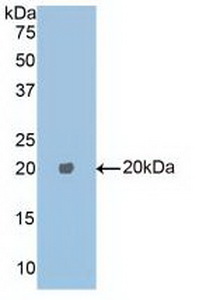 Polyclonal Antibody to Carboxypeptidase E (CPE)
