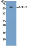 Polyclonal Antibody to Carboxypeptidase N1 (CPN1)