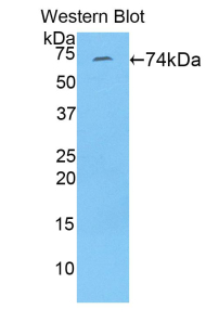 Polyclonal Antibody to Fibulin 4 (FBLN4)