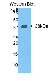 Polyclonal Antibody to Fibulin 4 (FBLN4)