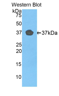 Polyclonal Antibody to Fibulin 4 (FBLN4)