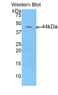 Polyclonal Antibody to Fibulin 4 (FBLN4)