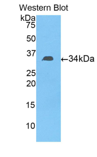 Polyclonal Antibody to Fibulin 3 (FBLN3)