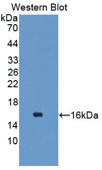 Polyclonal Antibody to Tetraspanin 1 (TSPAN1)