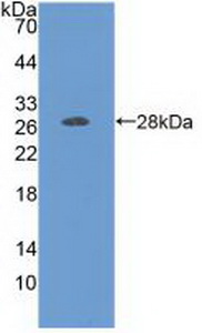 Polyclonal Antibody to Folate Receptor 1, Adult (FOLR1)