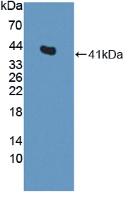Polyclonal Antibody to Centaurin Alpha 2 (CENTa2)