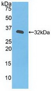 Polyclonal Antibody to Janus Kinase 3 (JAK3)