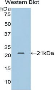 Polyclonal Antibody to Leukocyte Cell Derived Chemotaxin 2 (LECT2)