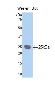 Polyclonal Antibody to Lysyl Oxidase Like Protein 1 (LOXL1)