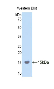 Polyclonal Antibody to Lysyl Oxidase Like Protein 2 (LOXL2)