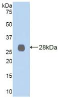 Polyclonal Antibody to Lysyl Oxidase Like Protein 2 (LOXL2)