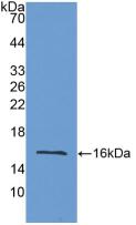 Polyclonal Antibody to Lysyl Oxidase Like Protein 2 (LOXL2)