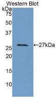 Polyclonal Antibody to Lysyl Oxidase Like Protein 3 (LOXL3)