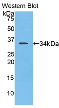 Polyclonal Antibody to Lysyl Oxidase Like Protein 4 (LOXL4)