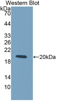 Polyclonal Antibody to Lysyl Oxidase Like Protein 4 (LOXL4)