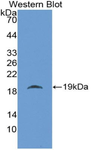 Polyclonal Antibody to Microfibrillar Associated Protein 5 (MFAP5)