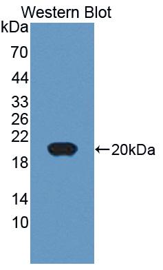 Polyclonal Antibody to Chordin Like Protein 2 (CHRDL2)