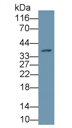 Polyclonal Antibody to Peptidyl Arginine Deiminase Type III (PADI3)
