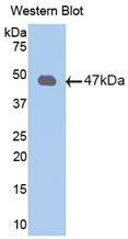 Polyclonal Antibody to Peroxiredoxin 2 (PRDX2)