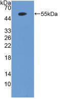 Polyclonal Antibody to Phosphatase And Tensin Homolog (PTEN)