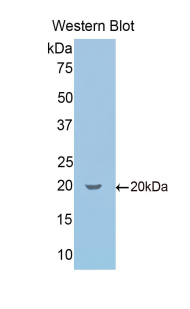 Polyclonal Antibody to Secretogranin II (SCG2)