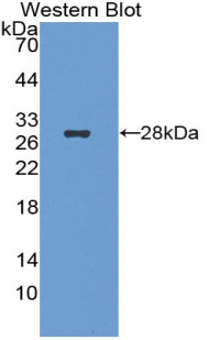 Polyclonal Antibody to Stanniocalcin 2 (STC2)