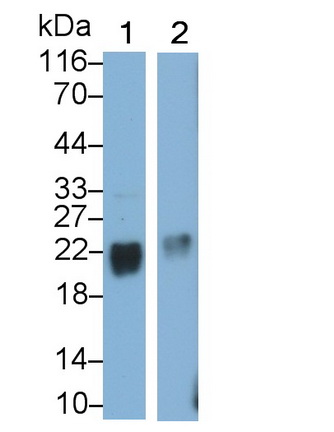 Polyclonal Antibody to Stathmin 2 (STMN2)