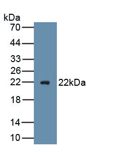 Polyclonal Antibody to Advillin (AVIL)