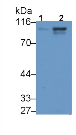 Polyclonal Antibody to Advillin (AVIL)