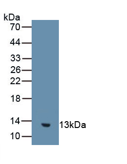 Polyclonal Antibody to Guanylate Cyclase Activator 2B (GUCA2B)