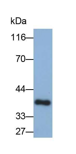 Polyclonal Antibody to Corin (CRN)