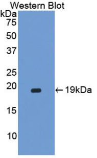 Polyclonal Antibody to Corin (CRN)