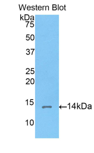 Polyclonal Antibody to Corin (CRN)