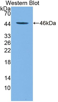 Polyclonal Antibody to Tryptophan Hydroxylase 2 (TPH2)