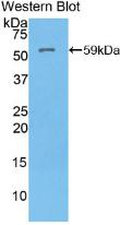 Polyclonal Antibody to ATPase, H+/K+ Exchanging Alpha Polypeptide (ATP4a)